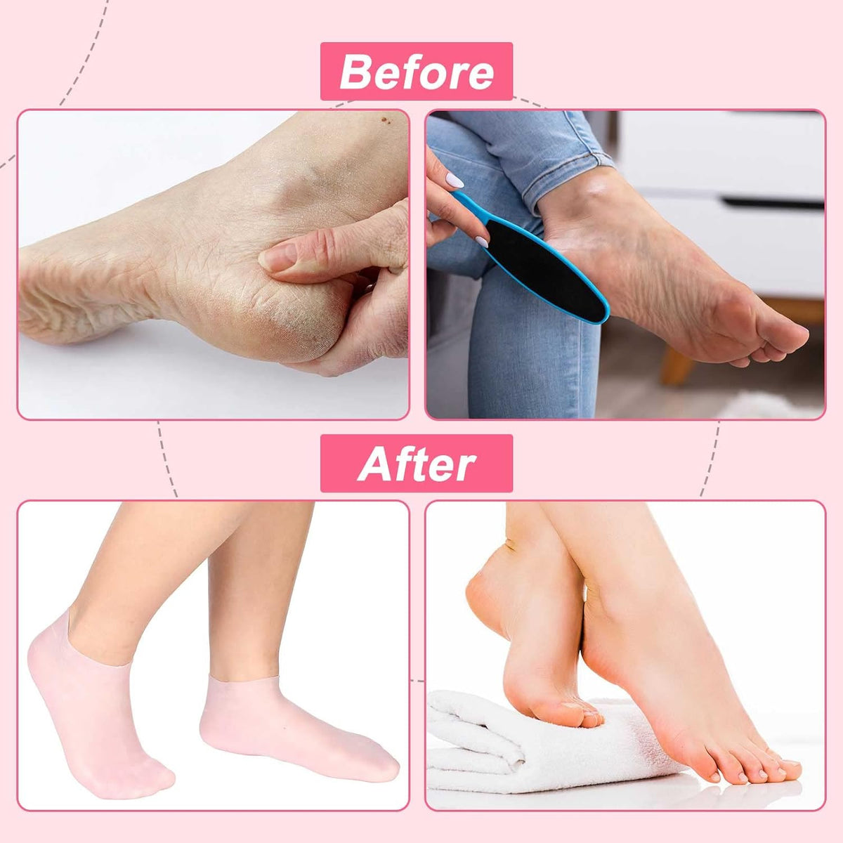 🔥Moisturizing Foot Mask Exfoliating Silicone Socks Beach Protective Socks